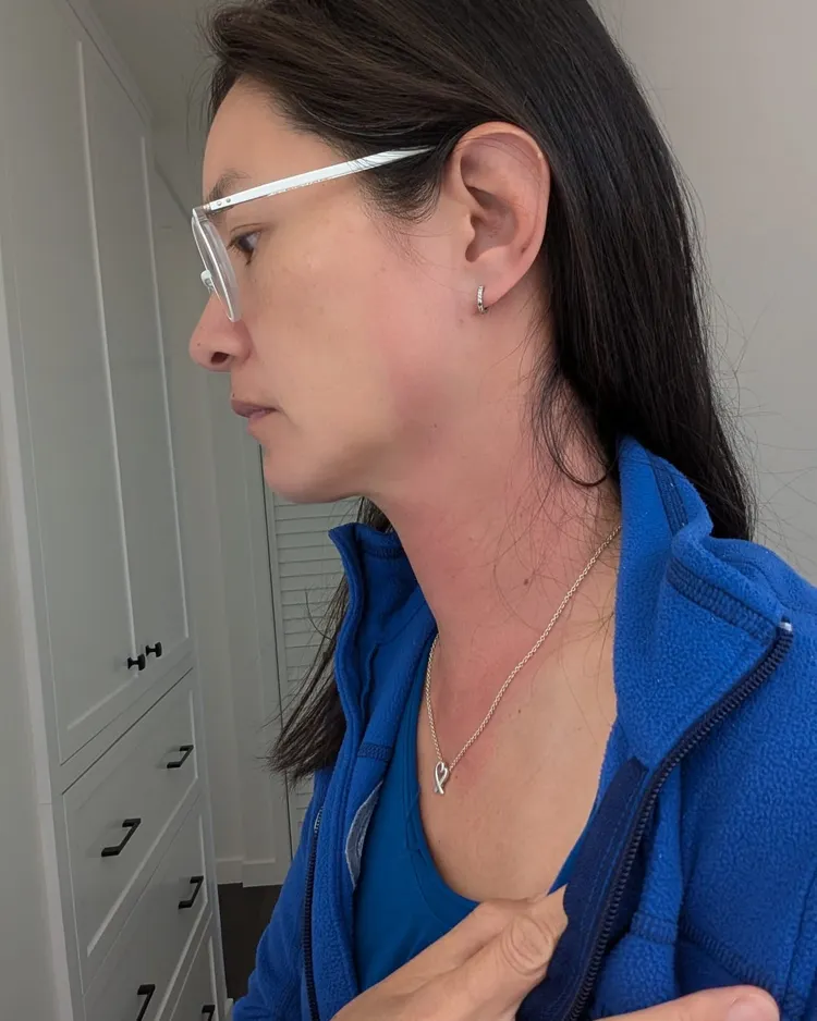 醫生推測Janet可能是壓力大造成。翻攝Janet臉書