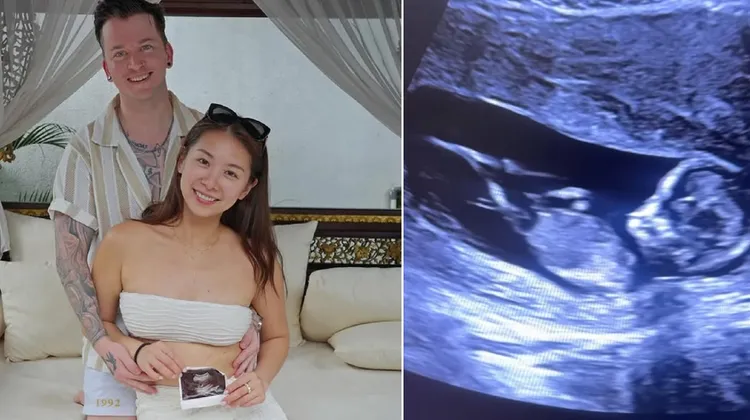 《黑澀會》米奇去年12月宣布懷孕喜訊。翻攝米奇IG