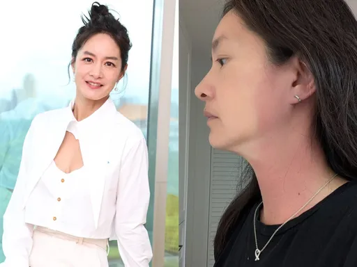 Janet身体出问题脖子红一块 检查后发现更年期要来了