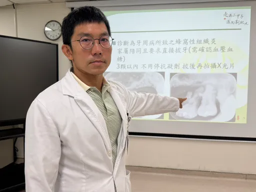 台中男牙痛想等大罷免後再就醫 結果蛀牙併發蜂窩性組織炎