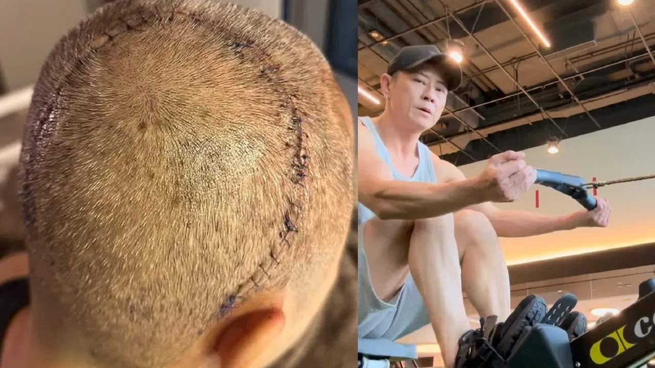 蔡一杰去年10月曝光脑瘤手术伤疤,之后勤运动调整状态。翻摄蔡一杰IG
