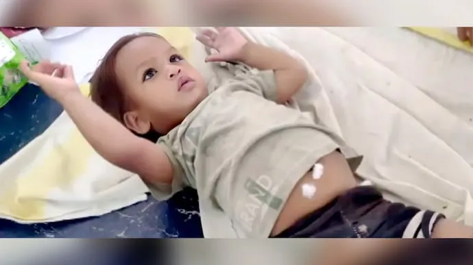 男童被送醫但情況無大礙。今日印度