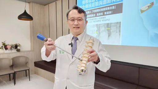 脊椎微創手術新突破 奇美醫院導入「可撐開式融合器」!助患者少痛快復原