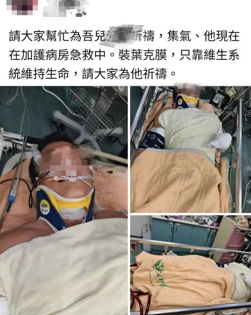 台電36歲員工觸電命危 父親PO病床照:請大家幫忙集氣