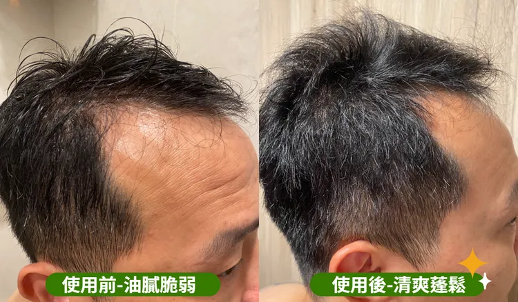 油頭讓人看起來髒髒的，網友實測使用草本主義涼感洗髮精後，立馬變得蓬鬆清爽。