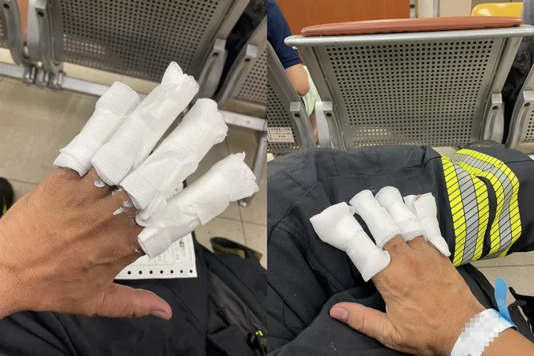 其中1名曾姓勇消10根手指有8根遭灼傷送醫。民眾提供
