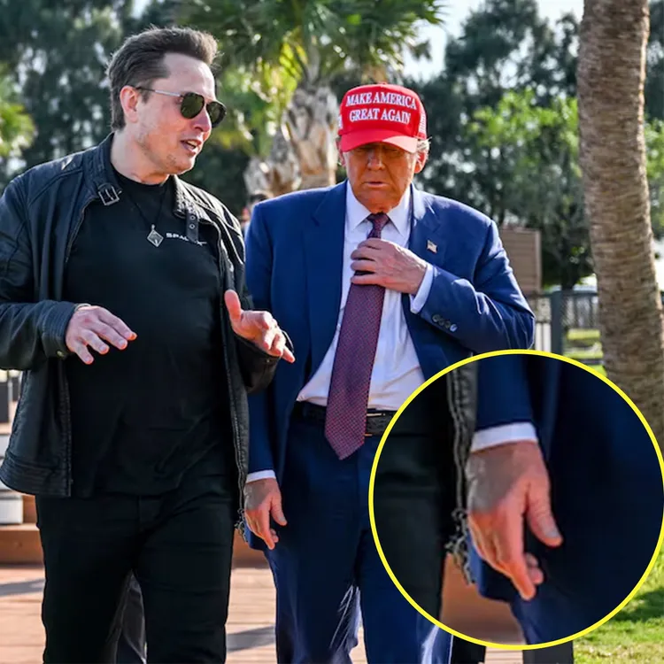 川普去年就被發現手背有大面積瘀青。翻攝自X @keithedwards