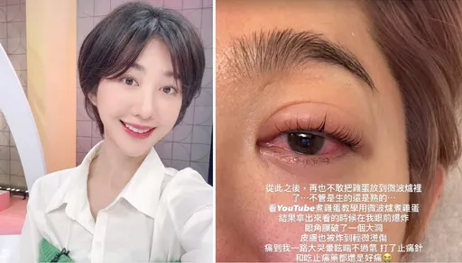 8点档女星鸡蛋放微波炉大爆炸!炸破眼角膜痛到一路哭