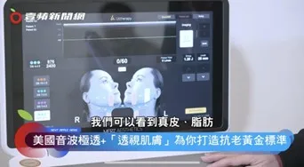 「美國音波極透+」專利透視超音波科技,搭配台灣推廣的醫師高階手法-S.P.T 黃金標準流程,讓醫師能精準鎖定每位患者的需求。