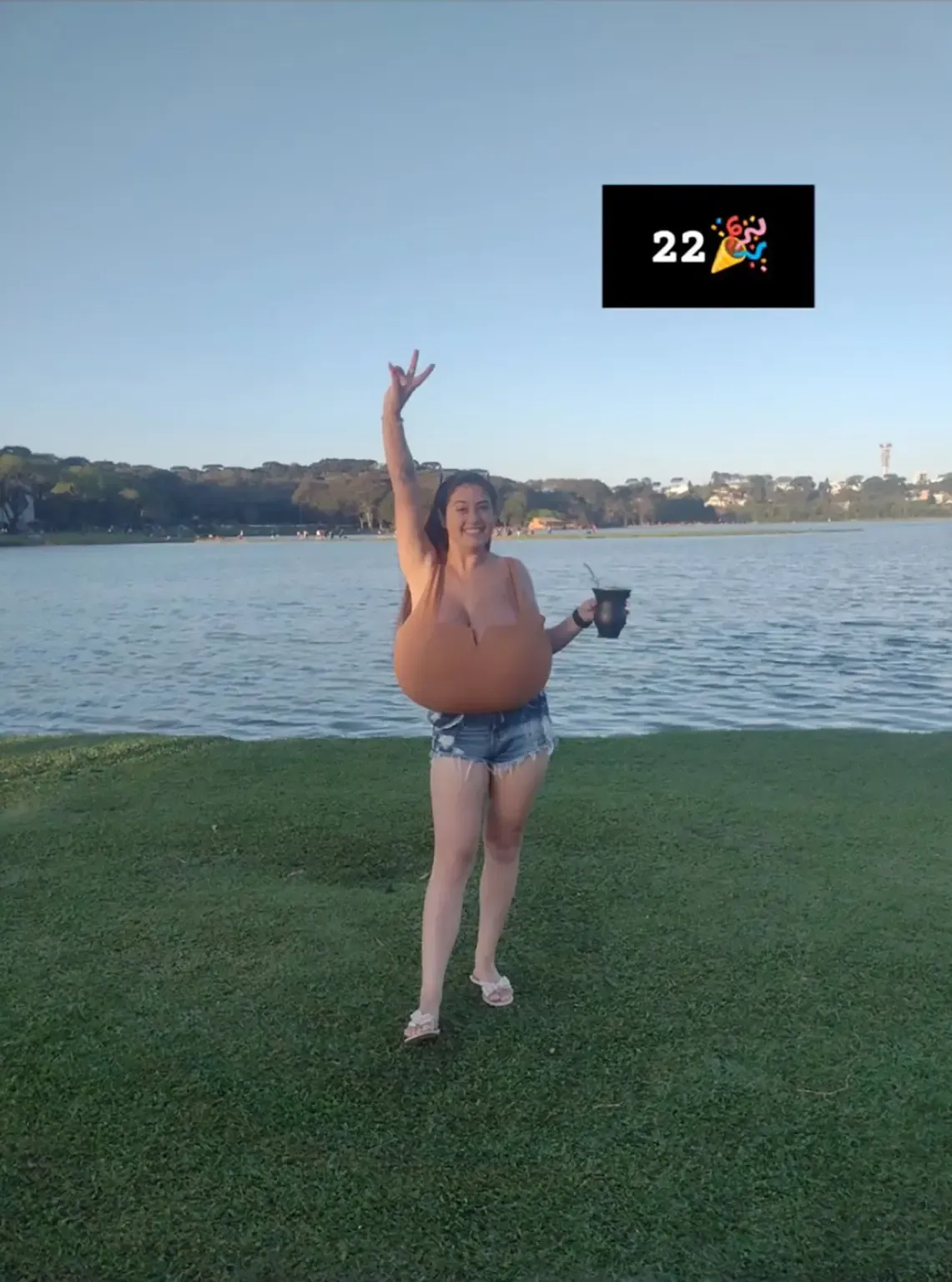巨乳症患者在日常生活中有不少困扰。