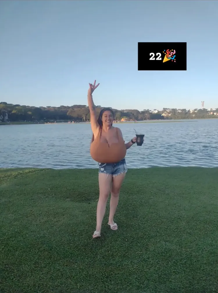 巨乳症患者在日常生活中有不少困擾。