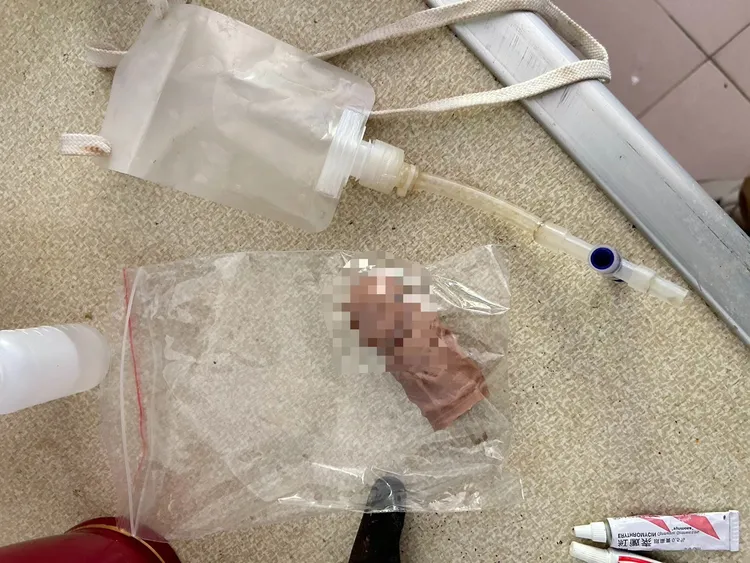 張嫌為了逃避尿檢，準備了假陽具與裝有正常人尿袋，在警察面前尿尿時掉包自己尿液。翻攝畫面