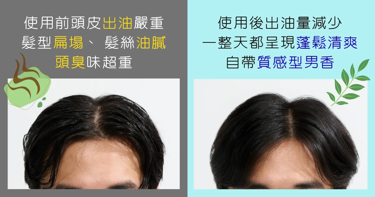 從油膩大叔變成清爽型男,就靠CLEAR「2X控油調理」來拯救頭皮!