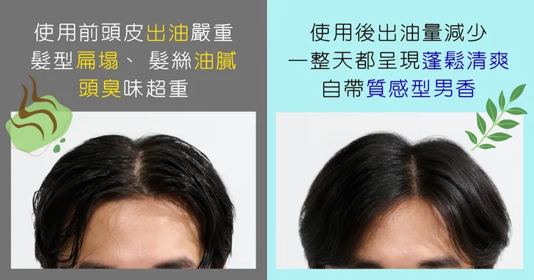 從油膩大叔變成清爽型男，就靠CLEAR「2X控油調理」來拯救頭皮！