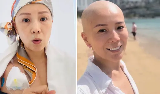 女星癌末公私立醫院檢驗報告大不同!癌指數降低腫瘤卻變大超無奈