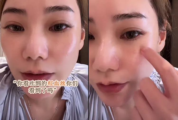 馬筱梅稱一直嘔吐，臉都冒出血絲。翻攝抖音