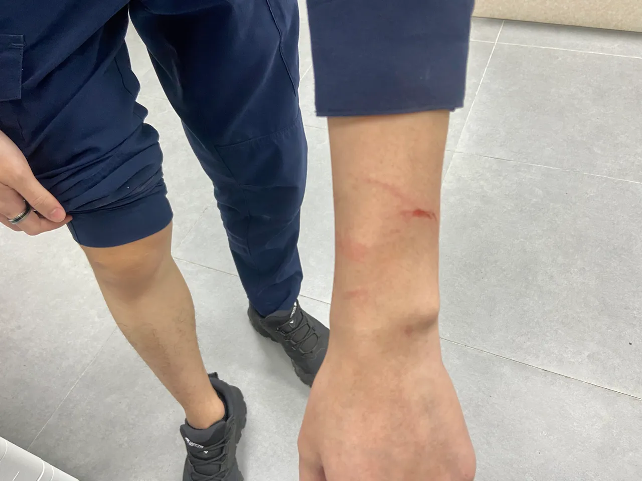 警员手部擦挫伤。中坜警分局提供