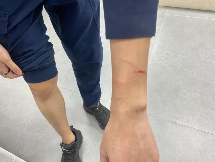 警員手部擦挫傷。中壢警分局提供