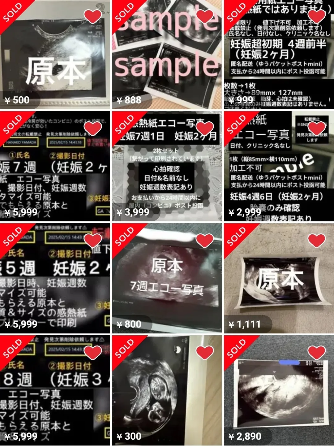 網拍販賣的胎兒超音波照。翻攝自X