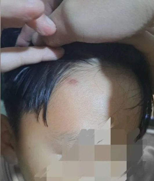 黃姓家長說，該名特教生曾以BB槍打傷其他學生。民眾提供