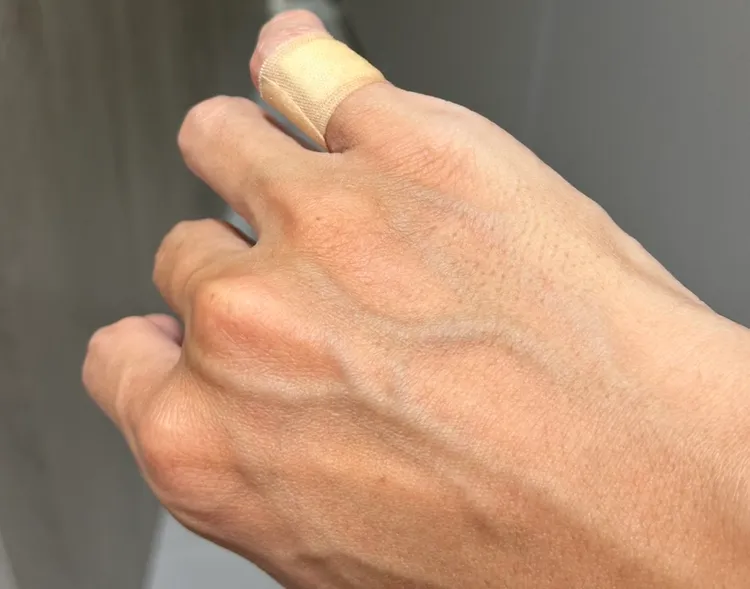 蘇姓警員用警棍敲車窗過程中不慎傷及手指流血，民眾目擊過程直呼非常英勇。翻攝畫面