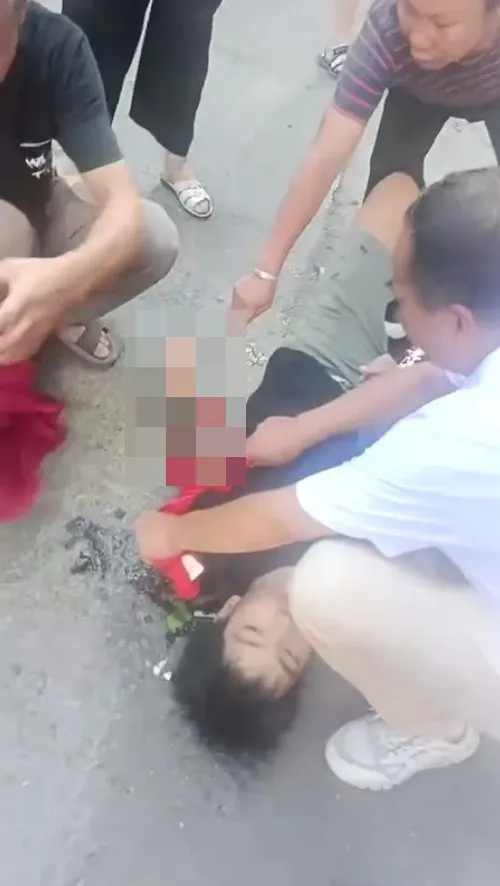 受傷學童。翻攝自X