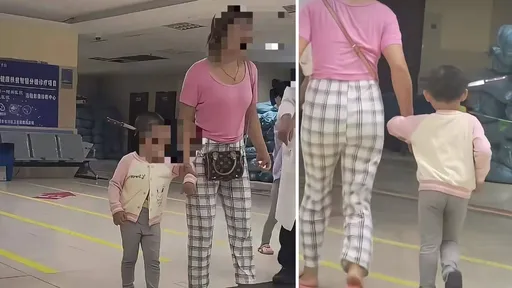 驚悚影片|3歲女童「頭插刀」淡定走進醫院 醫讚母做對1事