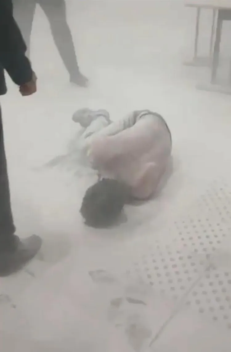 男子大面積燒傷。翻攝自X