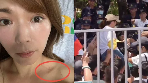 「總統府變天安門了?」陳智菡秀手臂、脖子抓痕!項鍊也遭警奪走