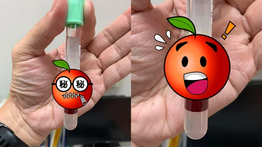 三酸甘油酯飙1677!抽血竟浮「超厚一层油」 惊人画面曝光