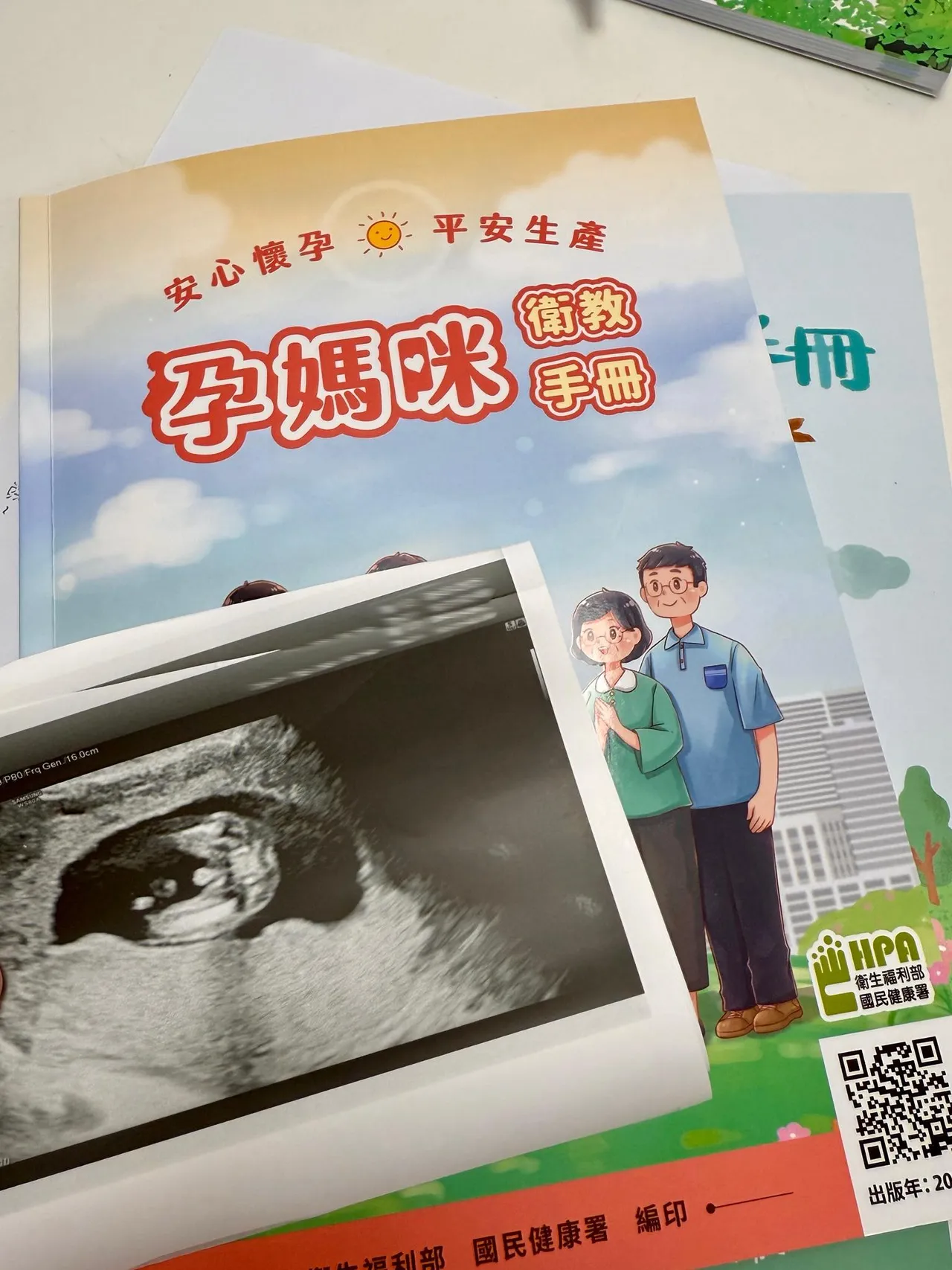 黄瀞莹12日在社群放上超音波照片。翻摄自黄瀞莹脸书