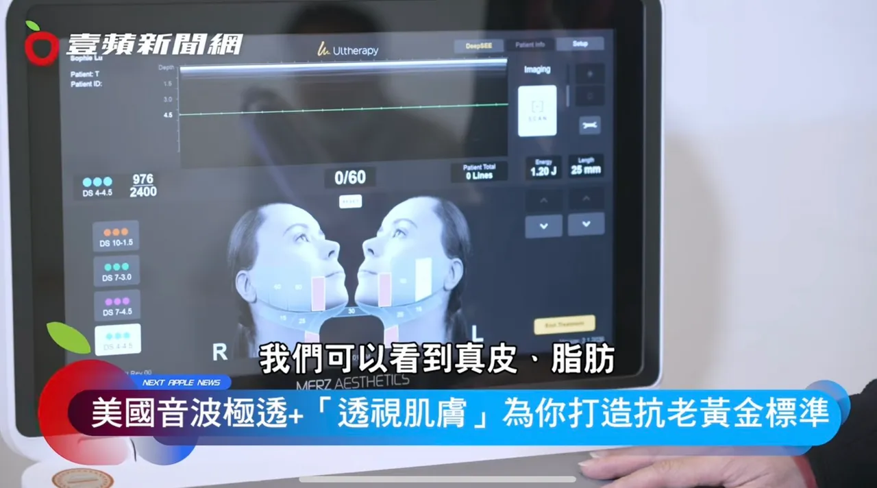 美国音波极透+专利透视超音波科技,让医师看见每张脸各部位的结构差异、精准判断能量落点。