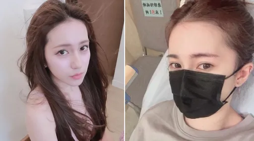 黑男混血靚妻血尿2瓶嚇到醫生!憋尿慘患「出血性膀胱炎」