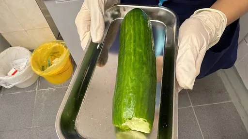 21歲女「超粗黃瓜爆菊」卡體內 醫護看懵了:誰咬了一口?