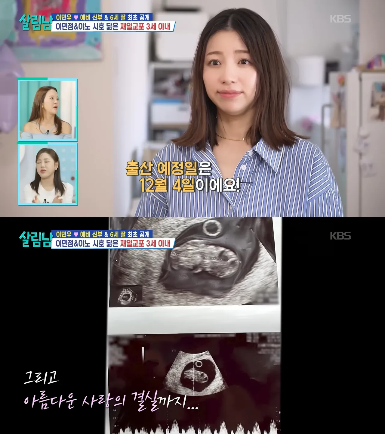 李亞美公開李玟雨女兒的超音波照片,透露預產期12月4日。翻攝KBS