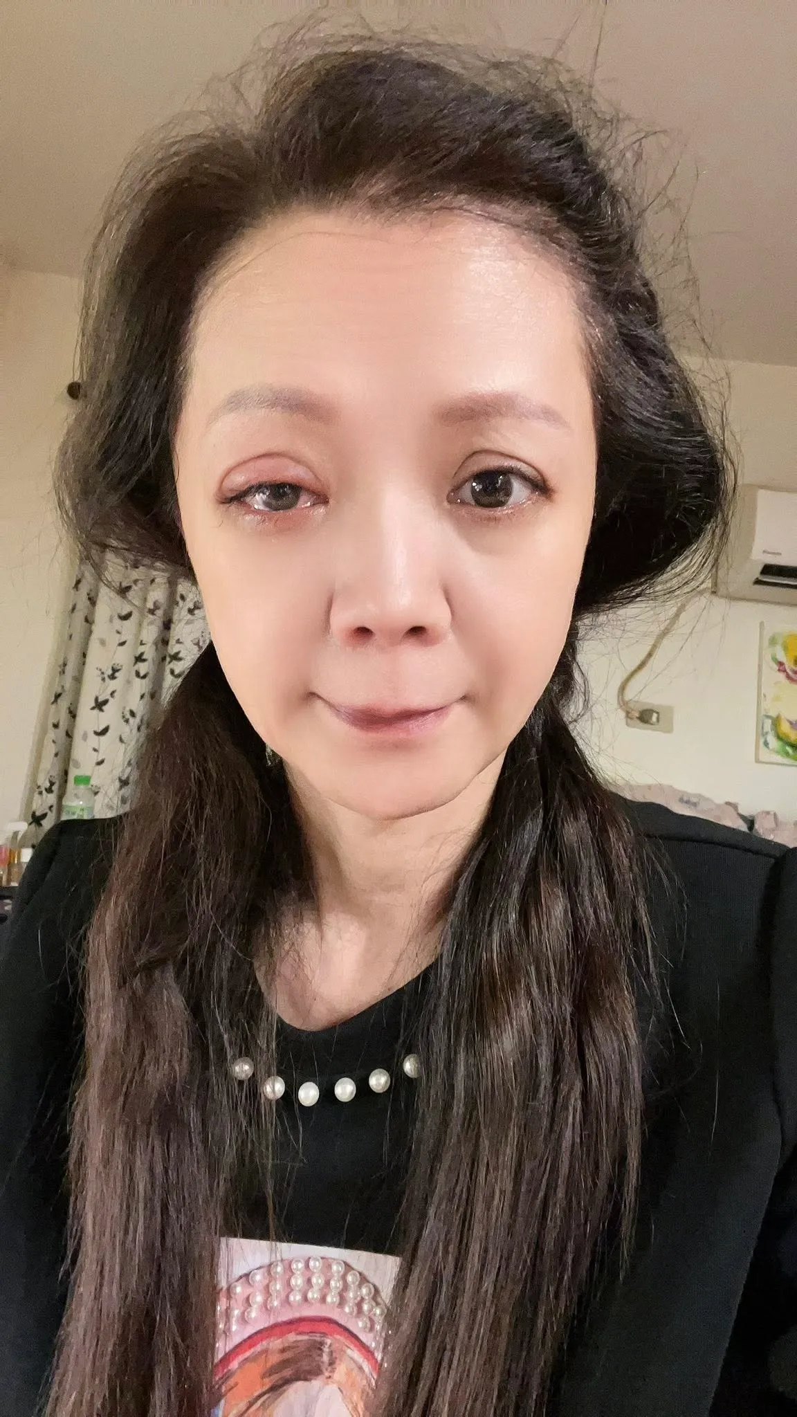高欣欣因为点错眼药水挂急诊。翻摄高欣欣脸书