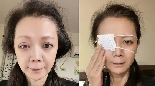 高欣欣点错眼药水看不到了!李国超急推老婆坐轮椅就医