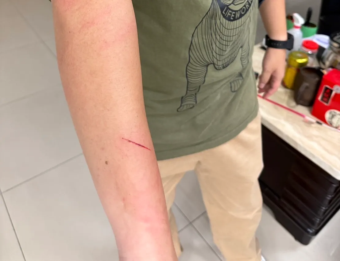 林姓警员在追捕过程中受伤。警方提供