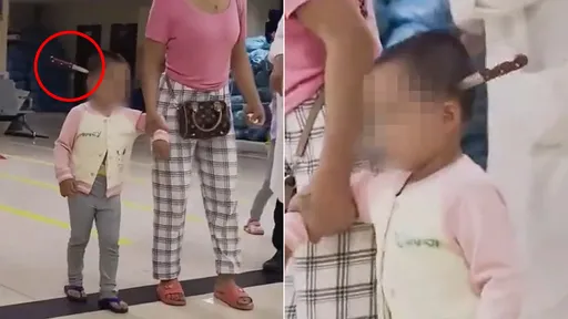 惊!3岁女童走进医院求助 脑袋上插著15公分水果刀