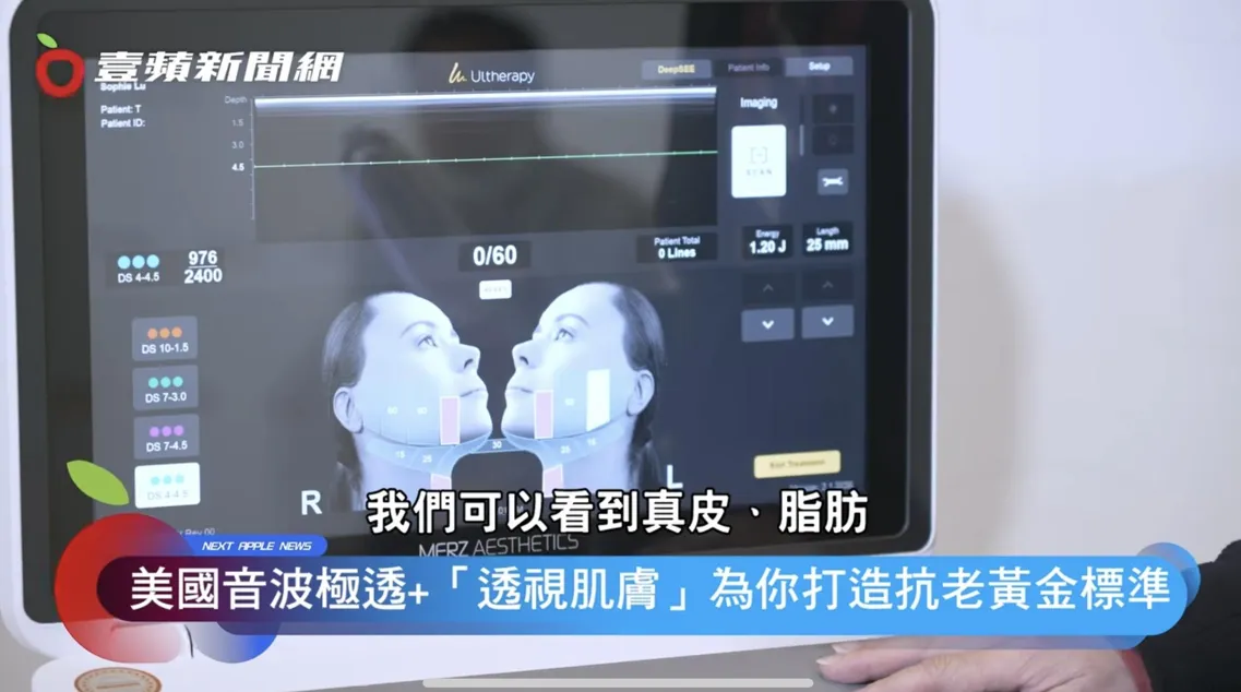 「美国音波极透+」专利透视超音波科技,搭配台湾推广的医师高阶手法-S.P.T 黄金标准流程,让医师能精准锁定每位患者的需求。