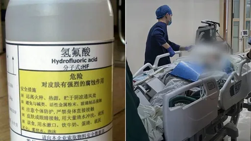 散步踩到塑胶瓶「竟是化骨水」 她烧伤3%就救不回来了