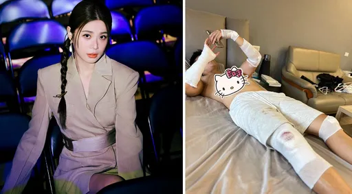 李燕闻外甥摔车翻5圈包成木乃伊!一路痛哭奔台中探视