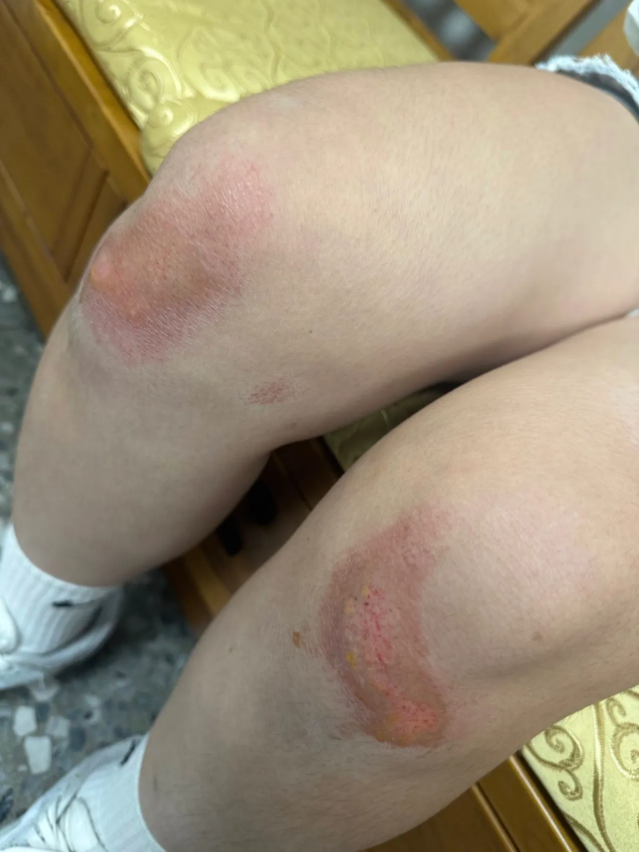 18岁的吴姓女子只因看电影时滑手机,遭邻座男子打伤。黄姓家长提供