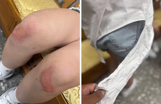 台中2少女看电影被拖出暴打!伤势曝光 父怒:以后谁敢让小孩出门?