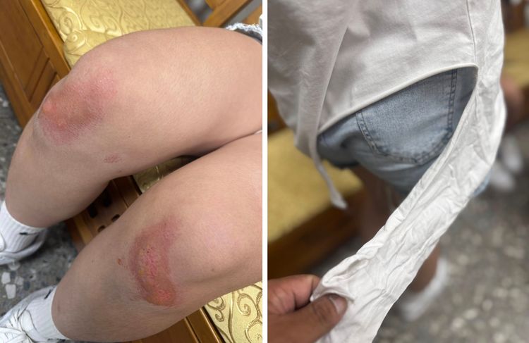 台中2少女看電影被拖出暴打！傷勢曝光　父怒：以後誰敢讓小孩出門？