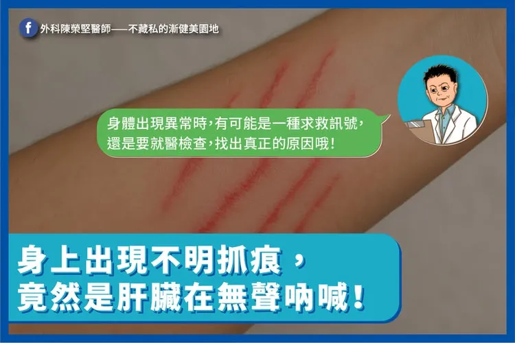 肝指數和黃疸指數高會引起皮膚搔癢而不自覺抓癢留下抓痕。圖取自陳榮堅醫師臉書