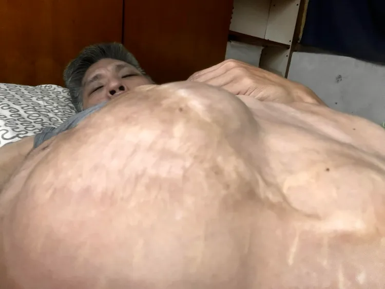 忠義表示會堅定面對治療，從不言棄。翻攝張中義臉書