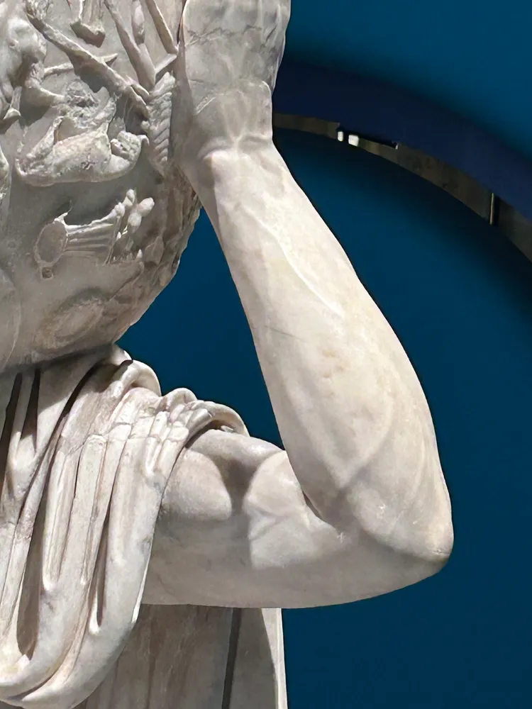 醫師讚嘆雕像手臂忠實呈現血管紋路。翻攝自X