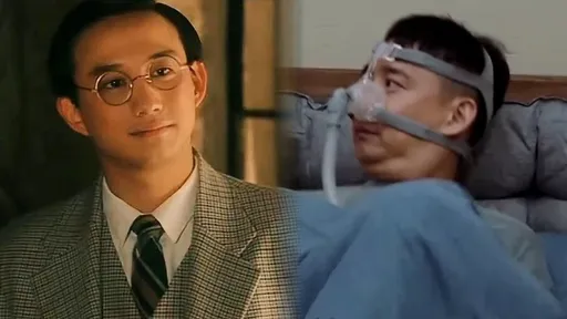 文青男星戴呼吸器治打鼾 曝光睡相沒偶包