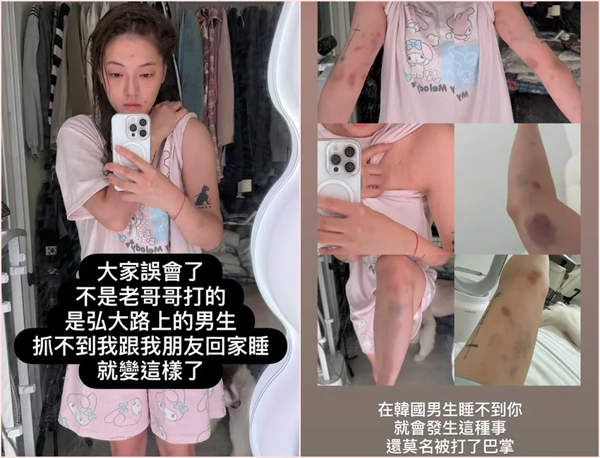 YTR刘力颖和朋友在首尔弘大夜店区遭男子殴打,她表示对方搭讪遭婉拒,竟然就殴打她们。翻摄自刘力颖IG